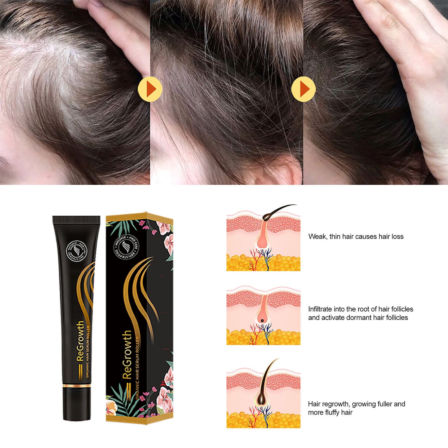 Regrowth Organic Hair Serum Roller Set Hair Care Anti Stripping Liquid Suitable For All Types Of Hair Loss Scalp Nourishing