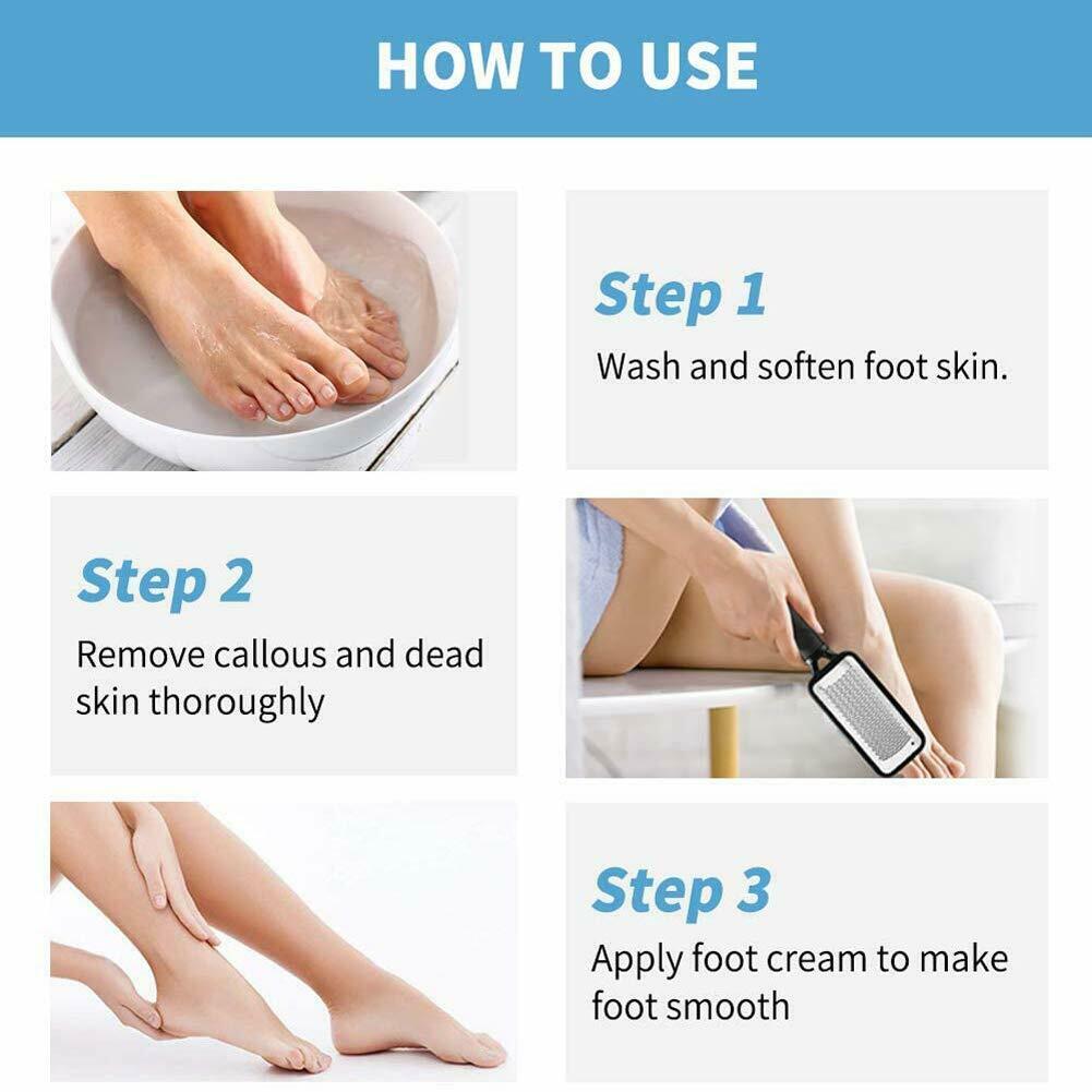 Professional Foot Callus Remover File Rasp Scraper Cracked Pedicure Rough Tool - myETYN