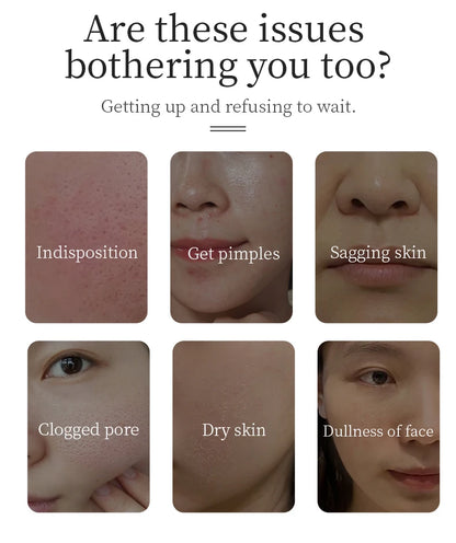 RF Facial Beauty Device with LED Photon Therapy