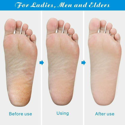 Professional Foot Callus Remover File Rasp Scraper Cracked Pedicure Rough Tool - myETYN