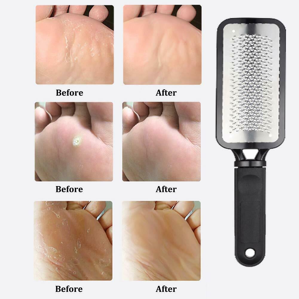 Professional Foot Callus Remover File Rasp Scraper Cracked Pedicure Rough Tool - myETYN