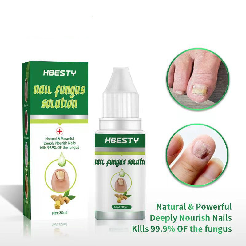 Nail Fungal Treatment Feet Care Nail Foot Toe Nail Fungus Removal Gel Anti Infection Paronychia Onychomycosis